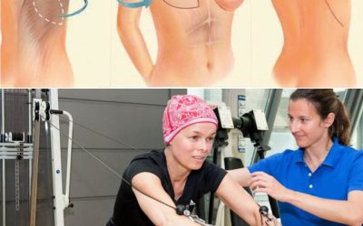 Câncer de Mama X Atividade Física e Exercício